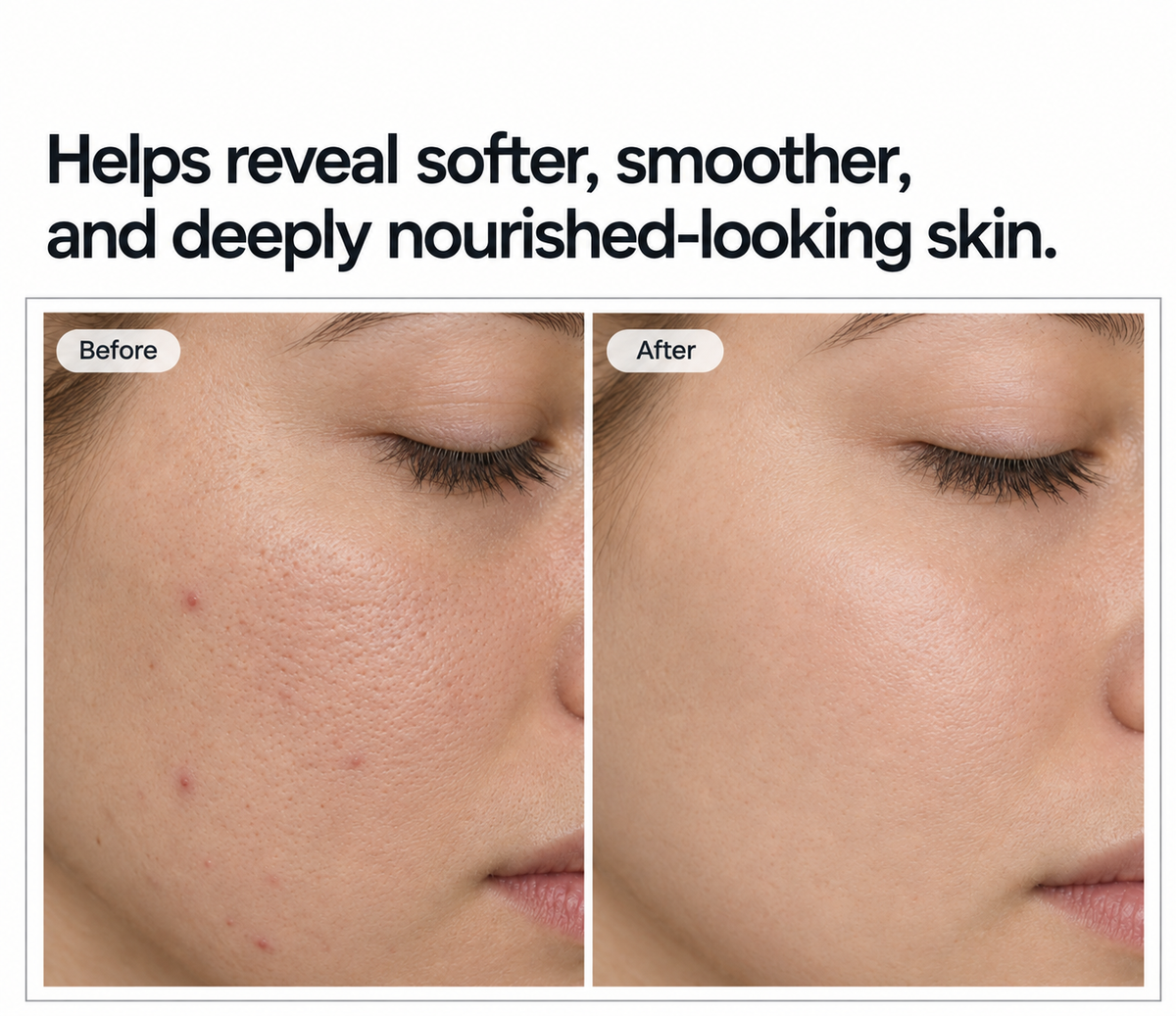 Glutathione Whitening Moisturiser